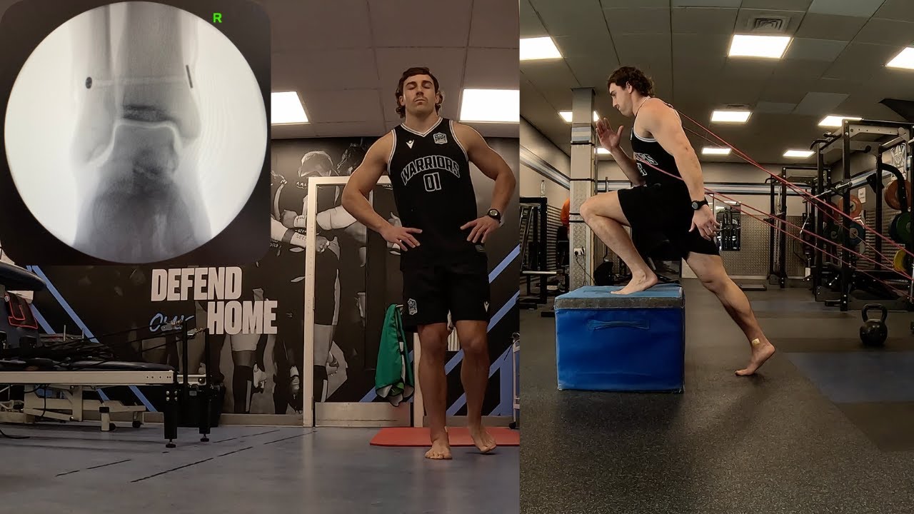Professional Rugby Player Ankle Rehab Weeks 1 to 3