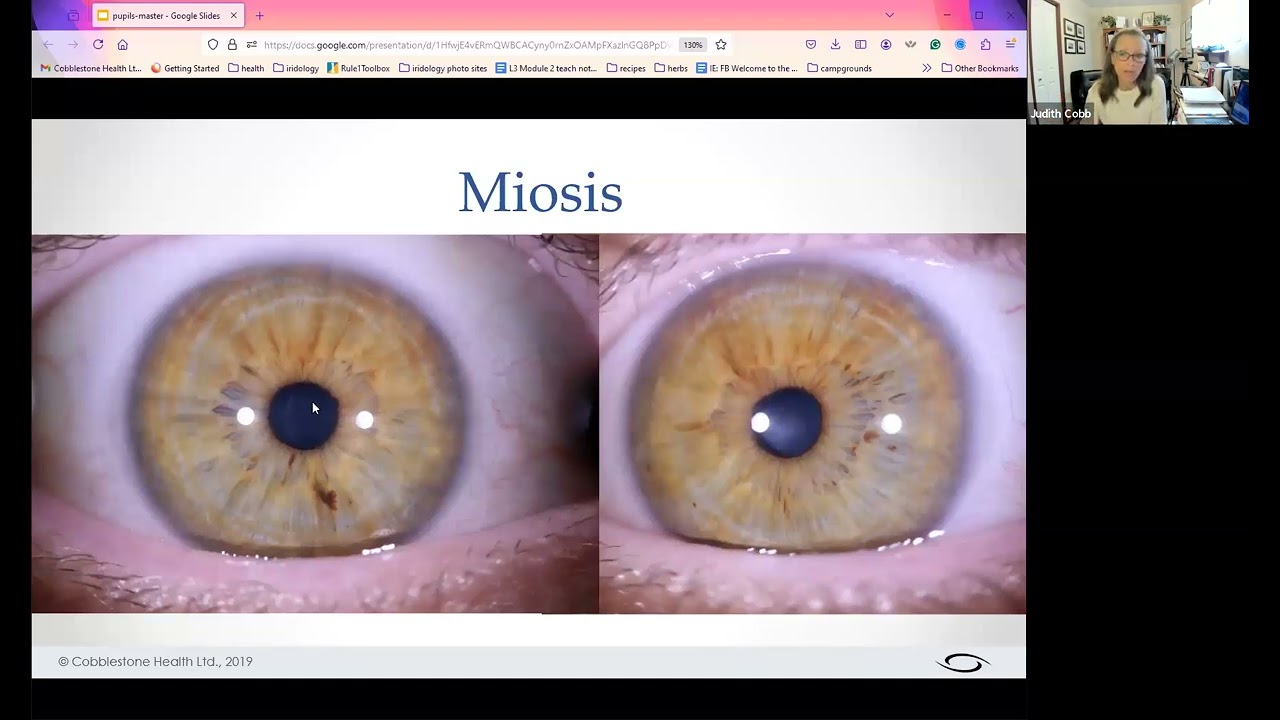 One more layer of information : the pupil