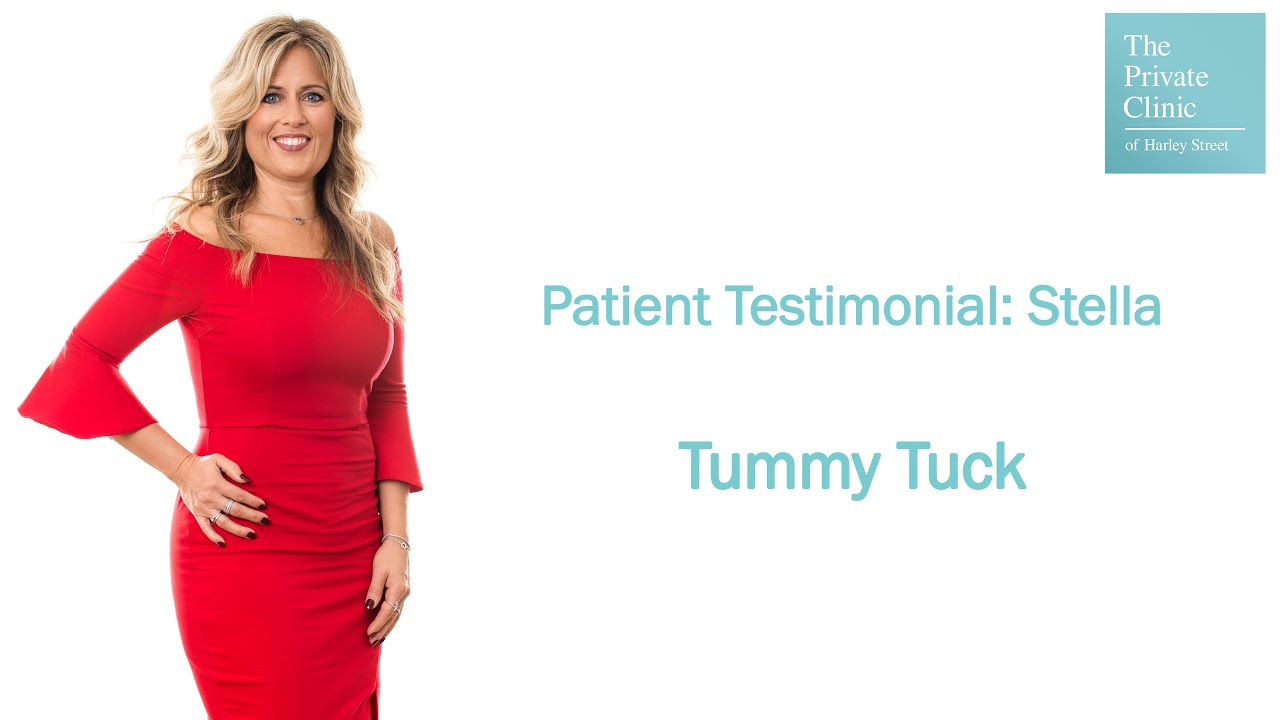 Tummy Tuck Patient Review -  Stella