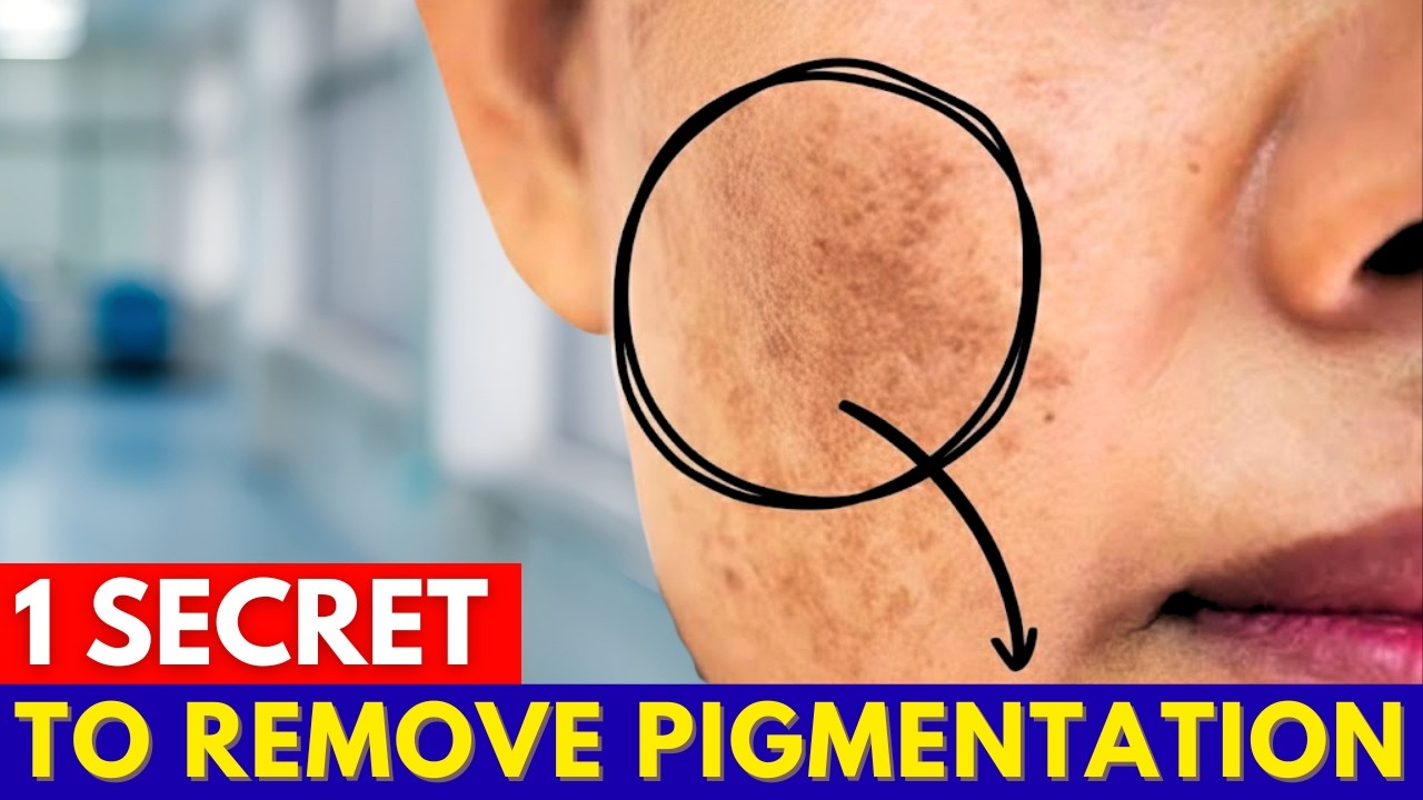 The Vitamin D 'Secret' That Makes Age Spots and Sun Spots Disappear Naturally