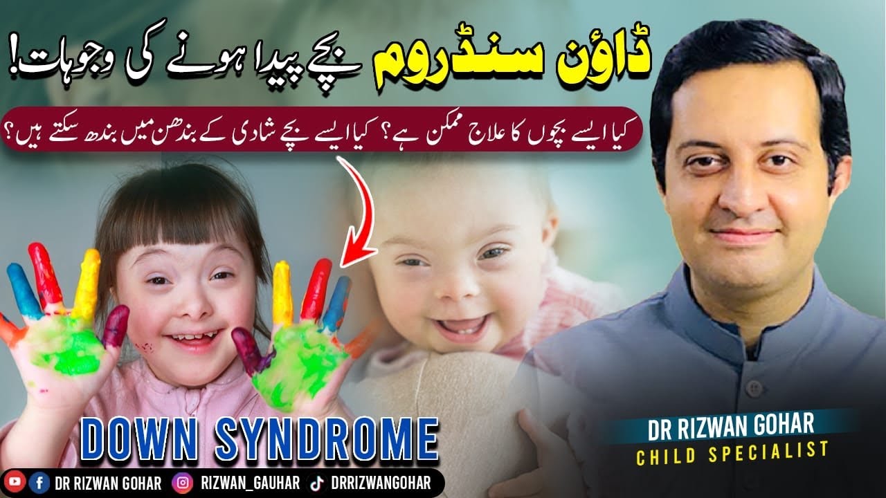 Discover the Amazing Treatment for Down Syndrome! 👶 #DownSyndrome  #Treatment