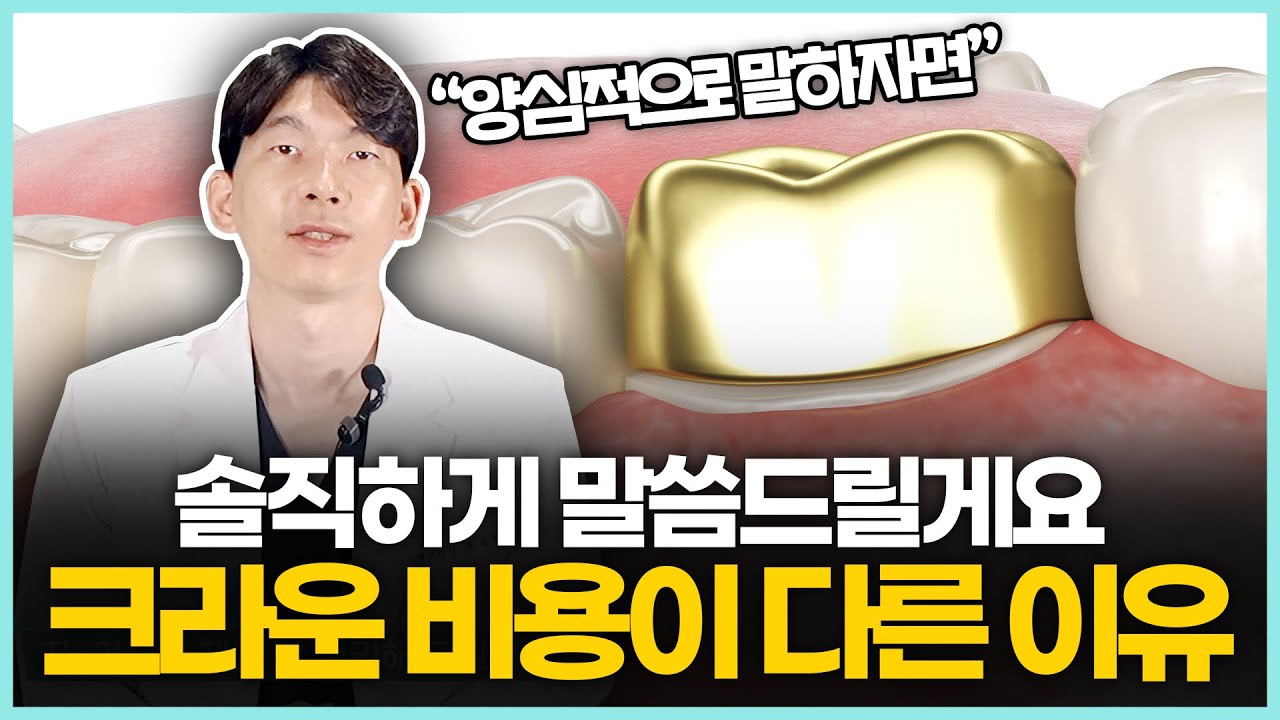 크라운 비용 치과마다 다른 이유 치료받기 전에 영상 보고 가세요! 치과 크라운 종류와 특징, 가격이 다른 이유!