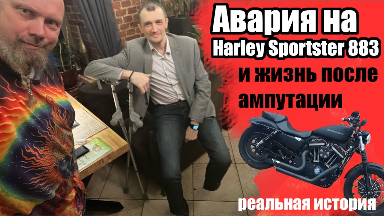 Авария на sportster 883 и жизнь после ампутации. Реальная история.