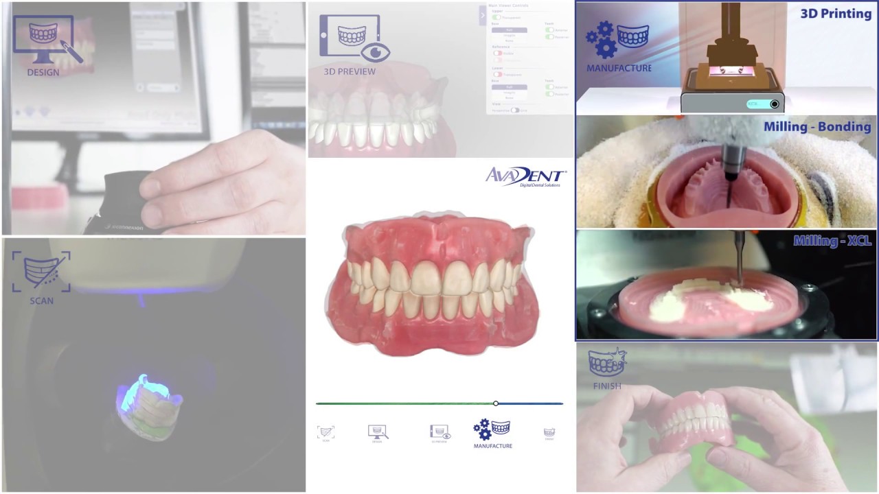 The AvaDent Workflow