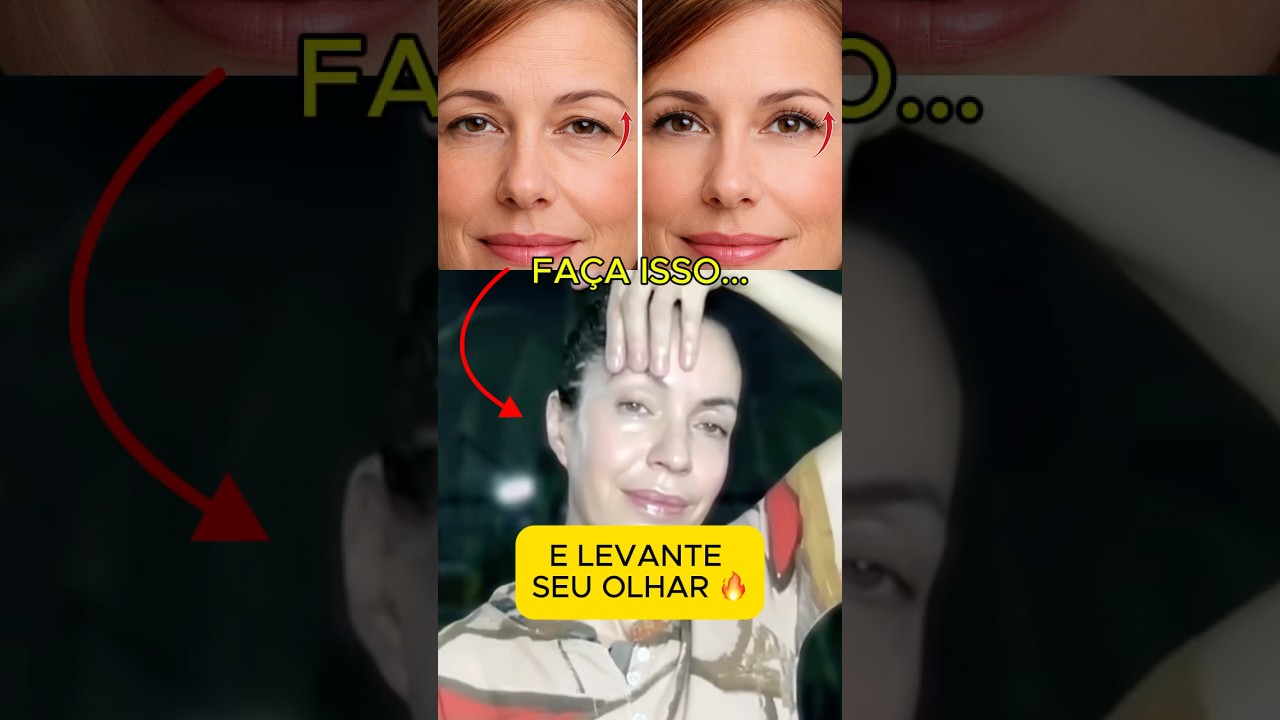 OLHAR CA&Iacute;DO? FA&Ccedil;A ISSO AGORA #liftingnatural #rejuvenescimento #beleza