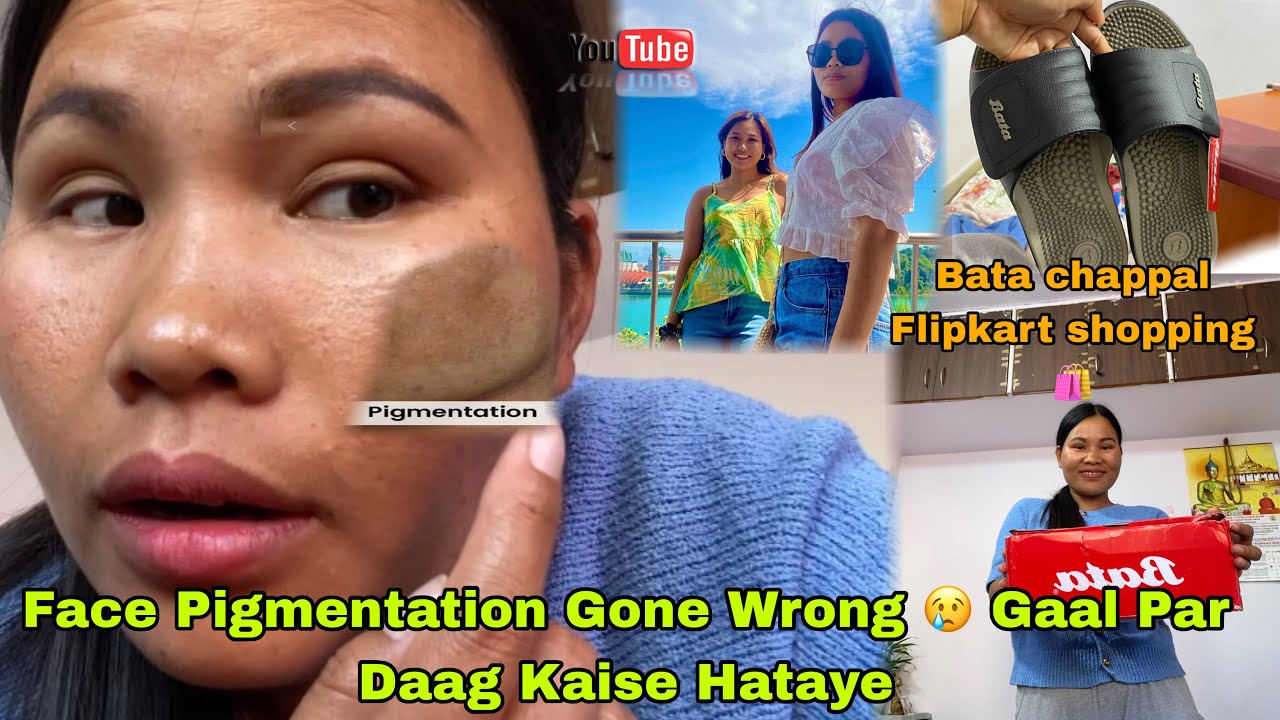 Face Pigmentation Gone Wrong 😢 | Gaal Par Daag Kaise Hataye? My Real Skin Journey