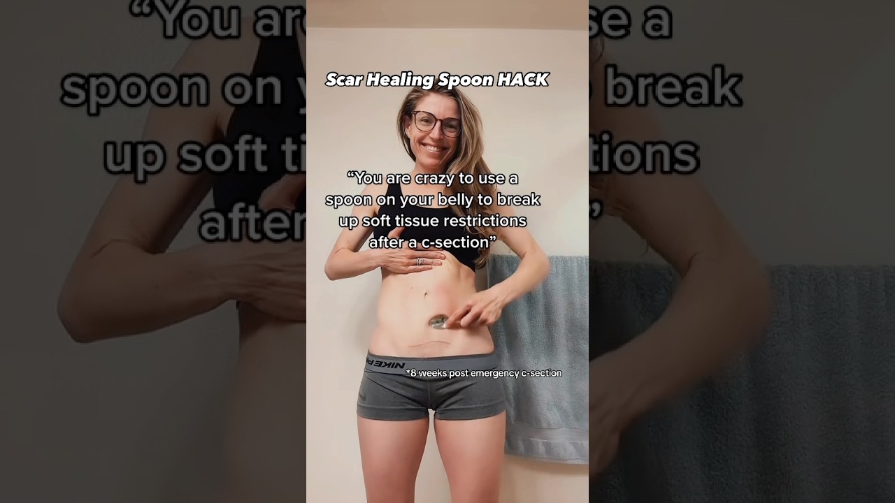 C-Section Scar & Belly Massage Spoon HACK! 