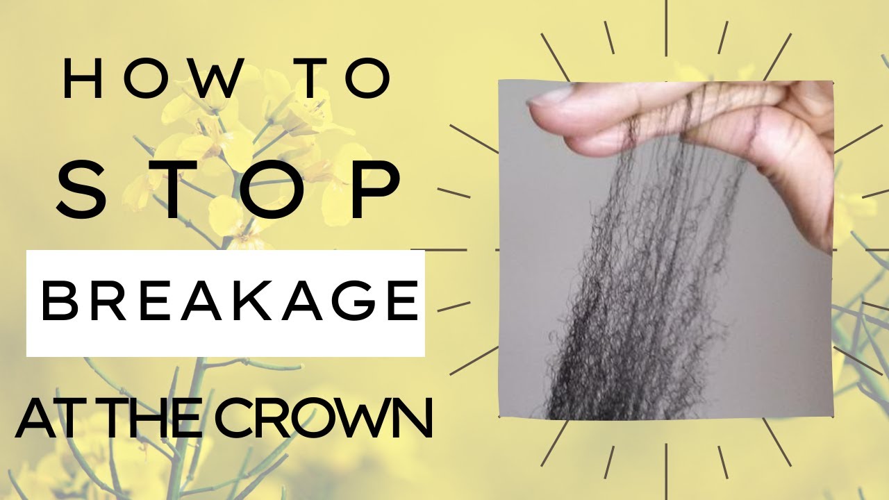 How to Stop Breakage In the Crown | Grow 4C Hair Long