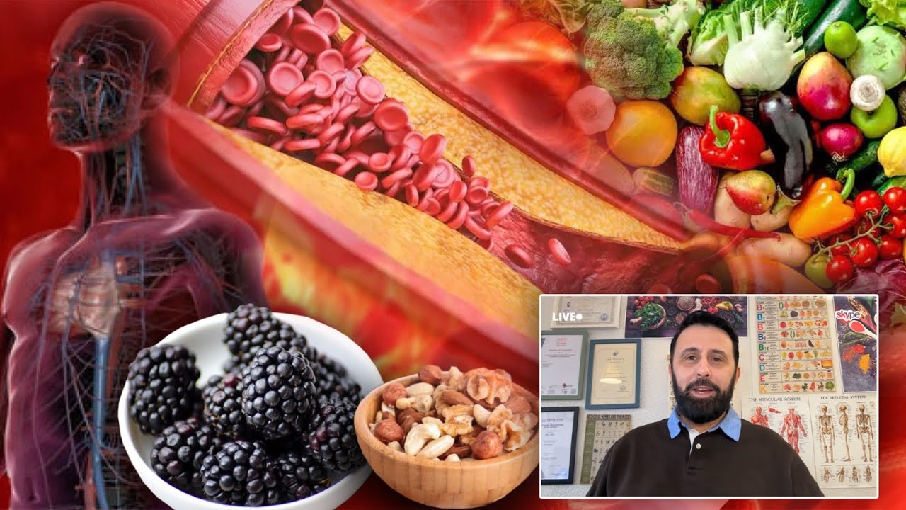 Si të pastroni arteriet me 20 produkte që i keni në shtëpi e të shpëtoni jetën nga 9 sëmundje