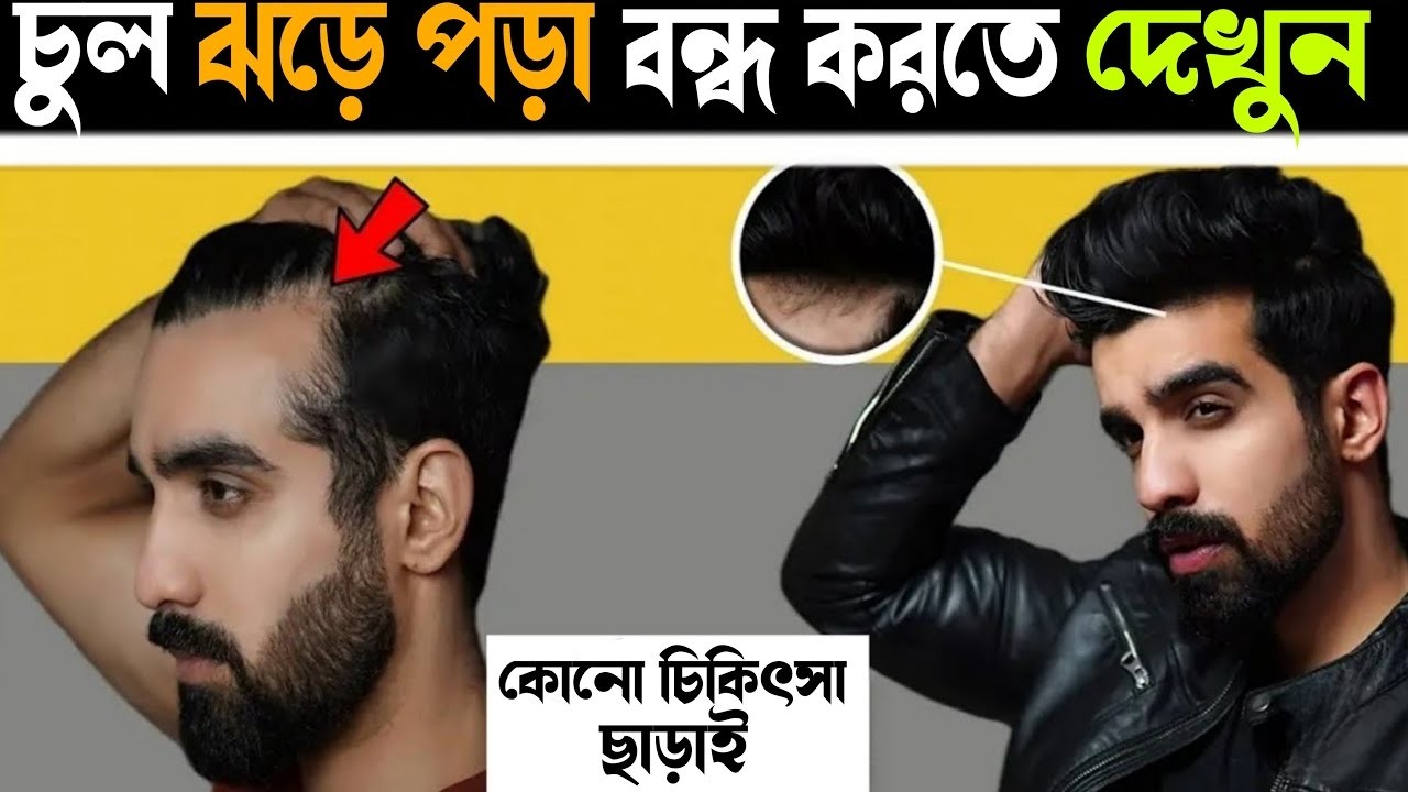 চুল পড়া বন্ধ ও নতুন চুল গজানোর উপায় | How To Grow Your Hair Faster And longer| Hair Fall Solution