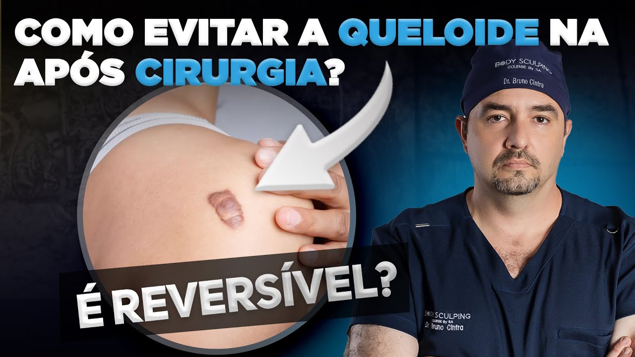 Como não ficar com QUELOIDE na CICATRIZ de uma cirurgia plástica? Médico Cirurgião Plástico responde