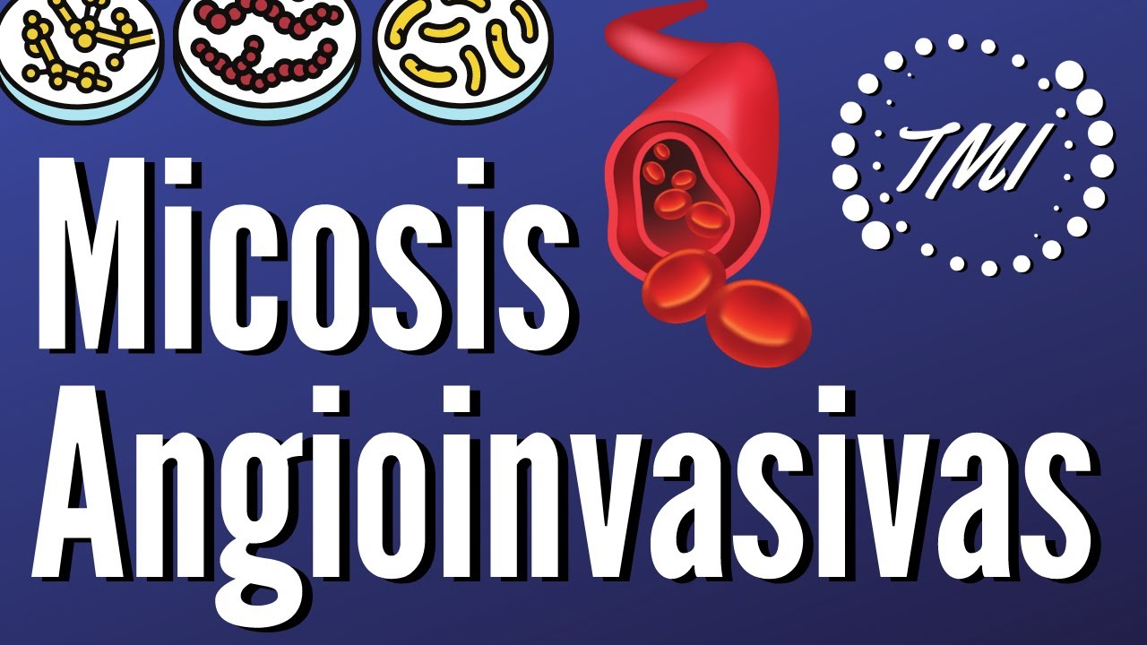 Micosis Angioinvasivas Explicadas Claramente