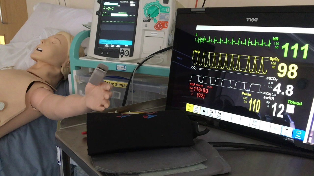 Patient Monitor