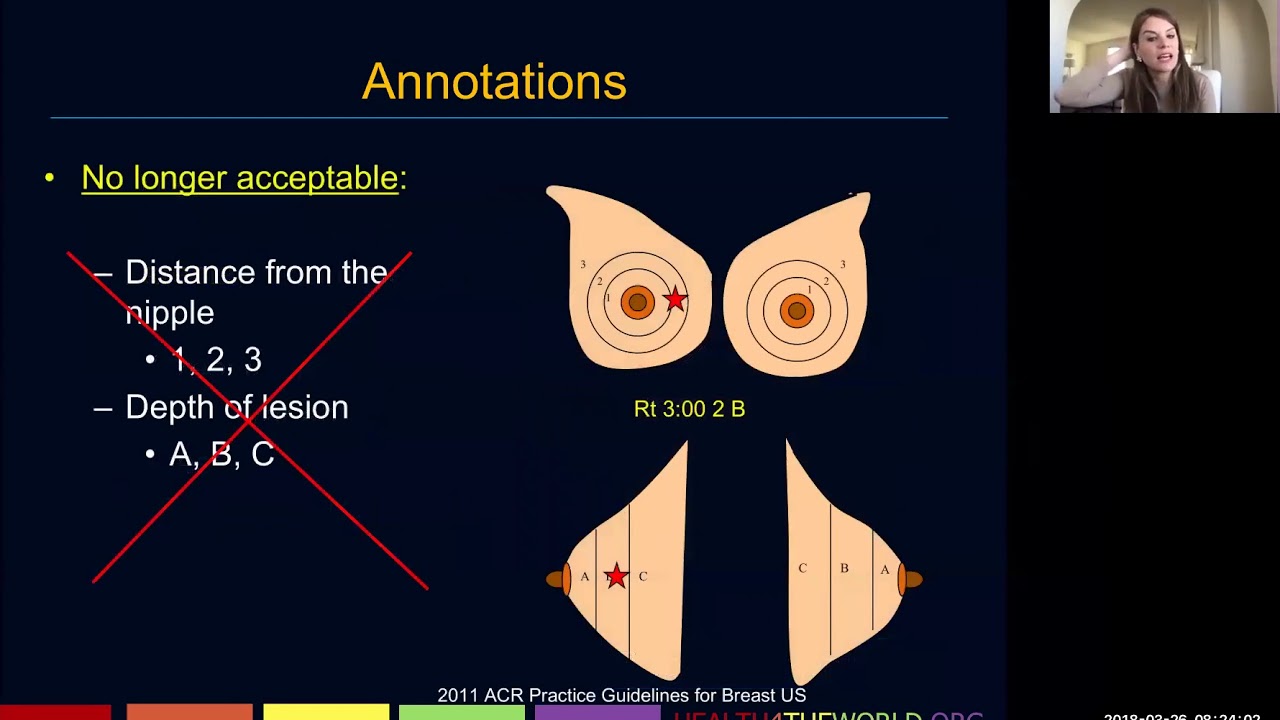 Breast Ultrasound - Part 3 | Health4TheWorld Academy