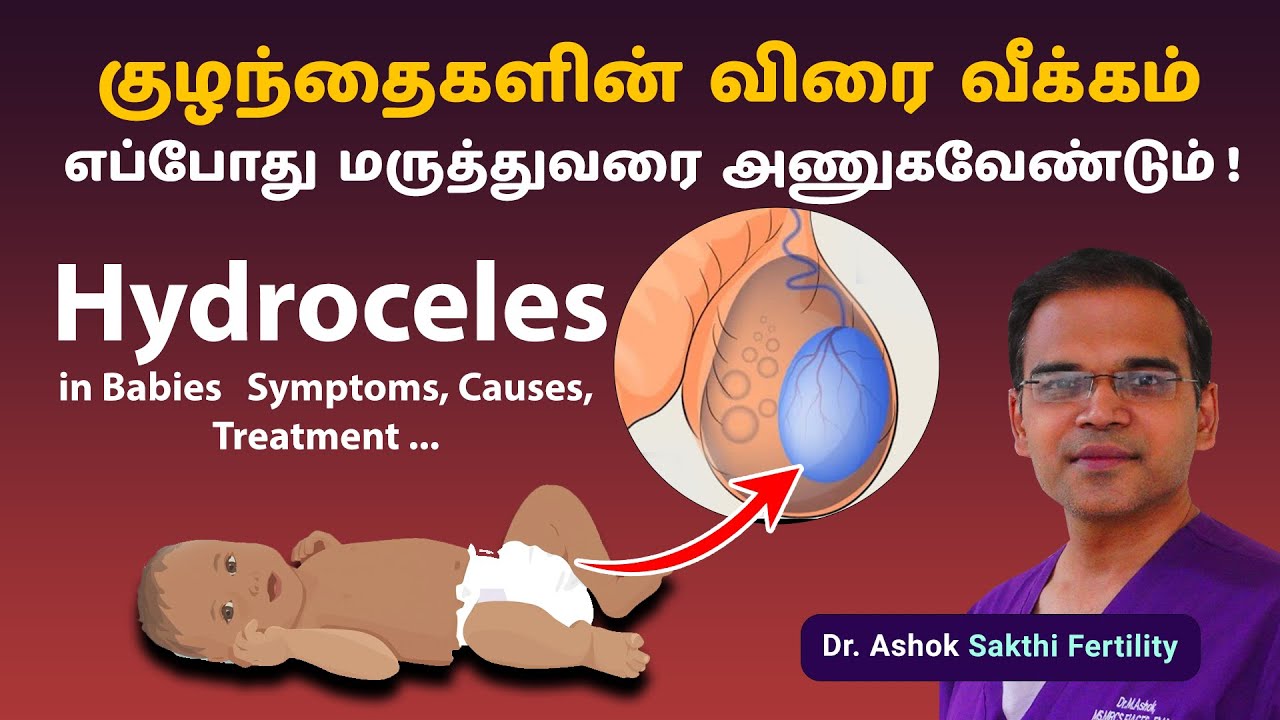 Hydrocele in babies : Causes, Diagnosis and Treatment in tamil