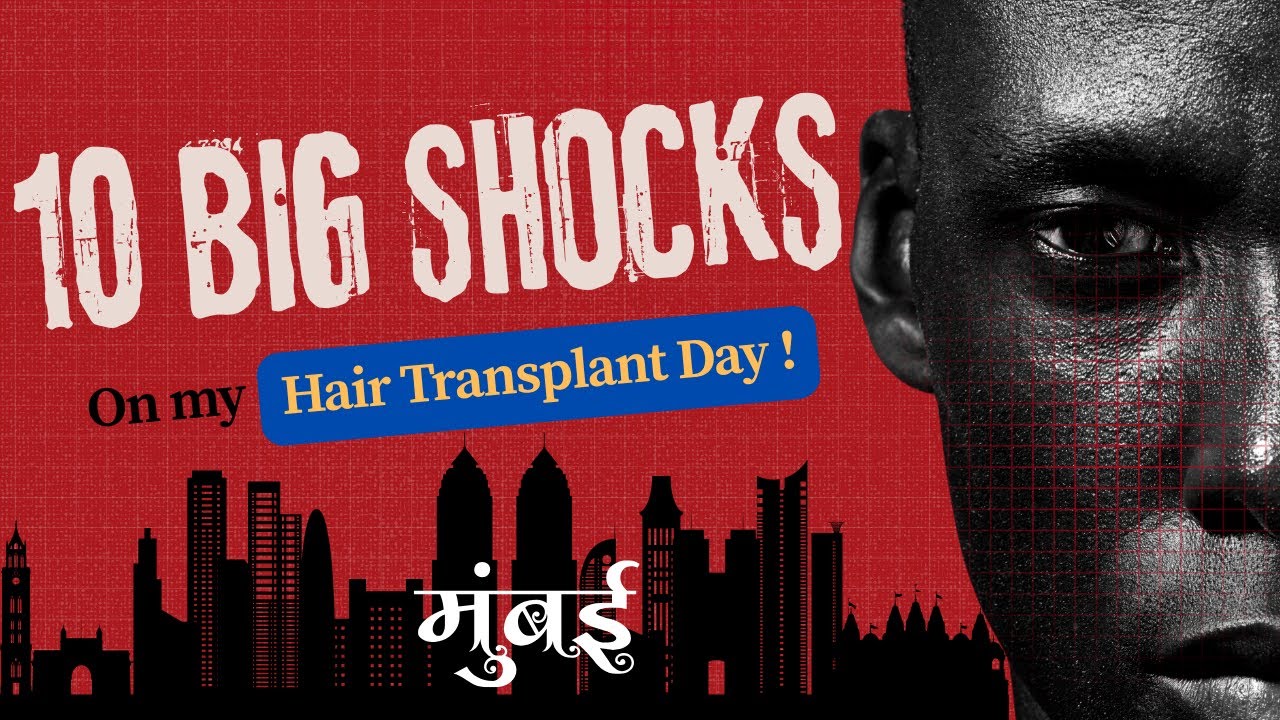Best Hair Transplant in Mumbai | Best Cost of Hair Transplant Mumbai #hairtransplantinmumbai
