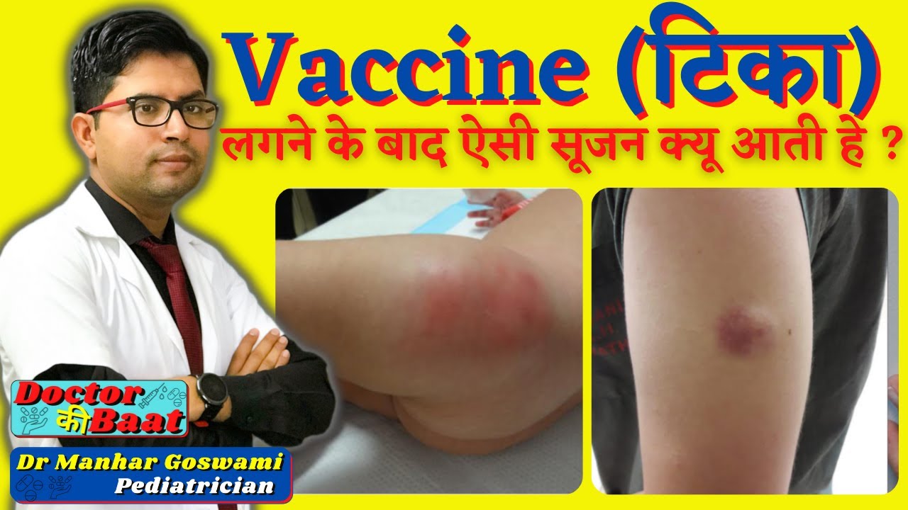 Post vaccine complication | Prevention and Treatment | Post vaccine Hematoma | Vaccine site abscess