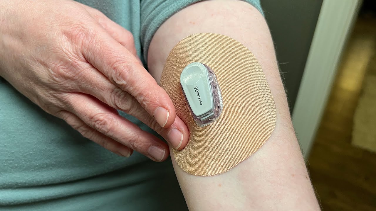 Dexcom G6 Adhesive Patches