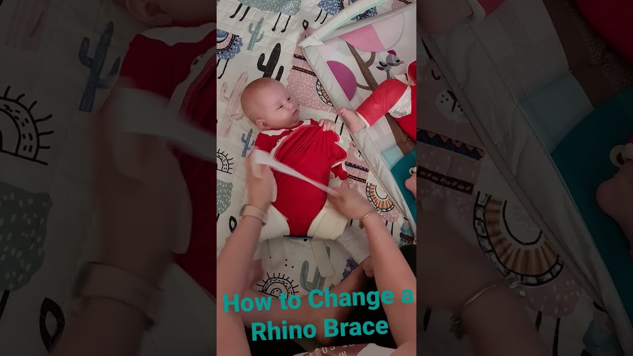 how to change a rhino brace