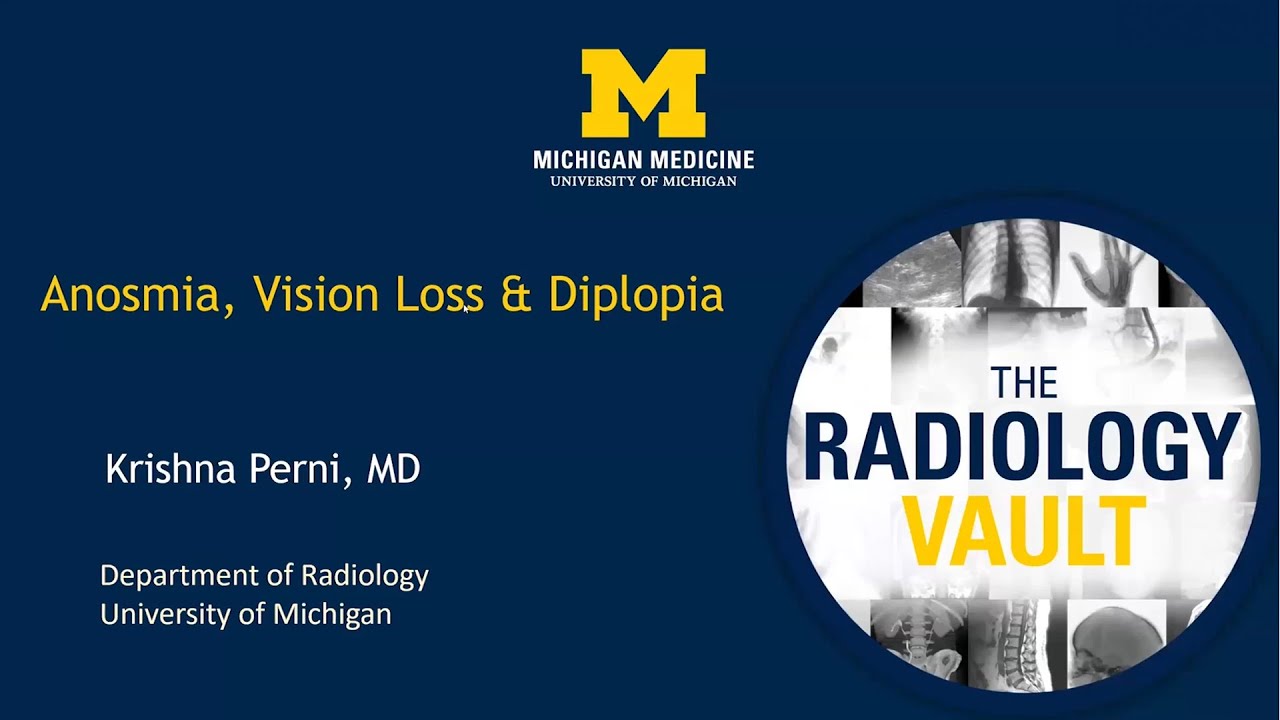 MRI & CT of Anosmia, Vision Loss & Diplopia