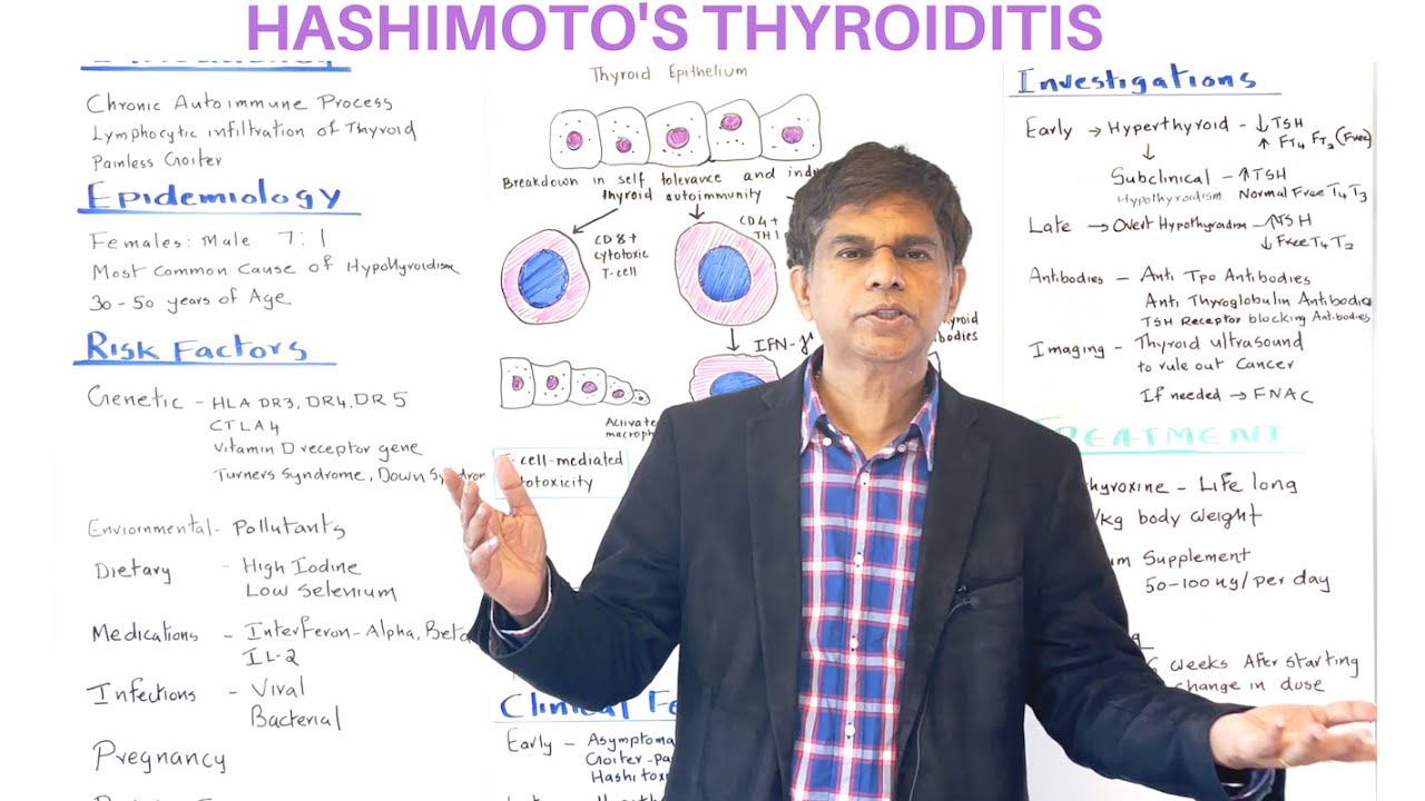 HASHIMOTO'S THYROIDITIS - AN OVERVIEW - By Pramil Cheriyath MD