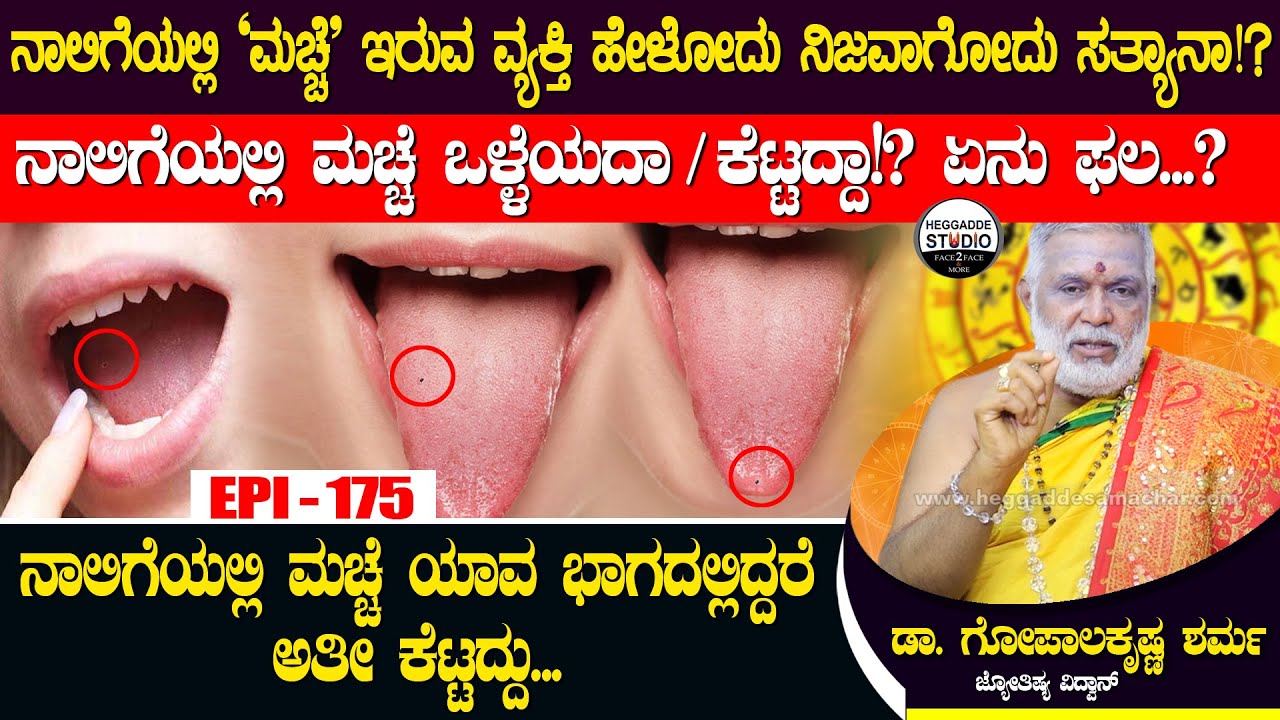 ನಾಲಿಗೆಯಲ್ಲಿ 'ಮಚ್ಚೆ' ಇರುವ ವ್ಯಕ್ತಿ ಹೇಳೋದು ನಿಜವಾಗೋದು ಸತ್ಯಾನಾ!? | GopalaKrishna Sharma Epi 175| Heggadde