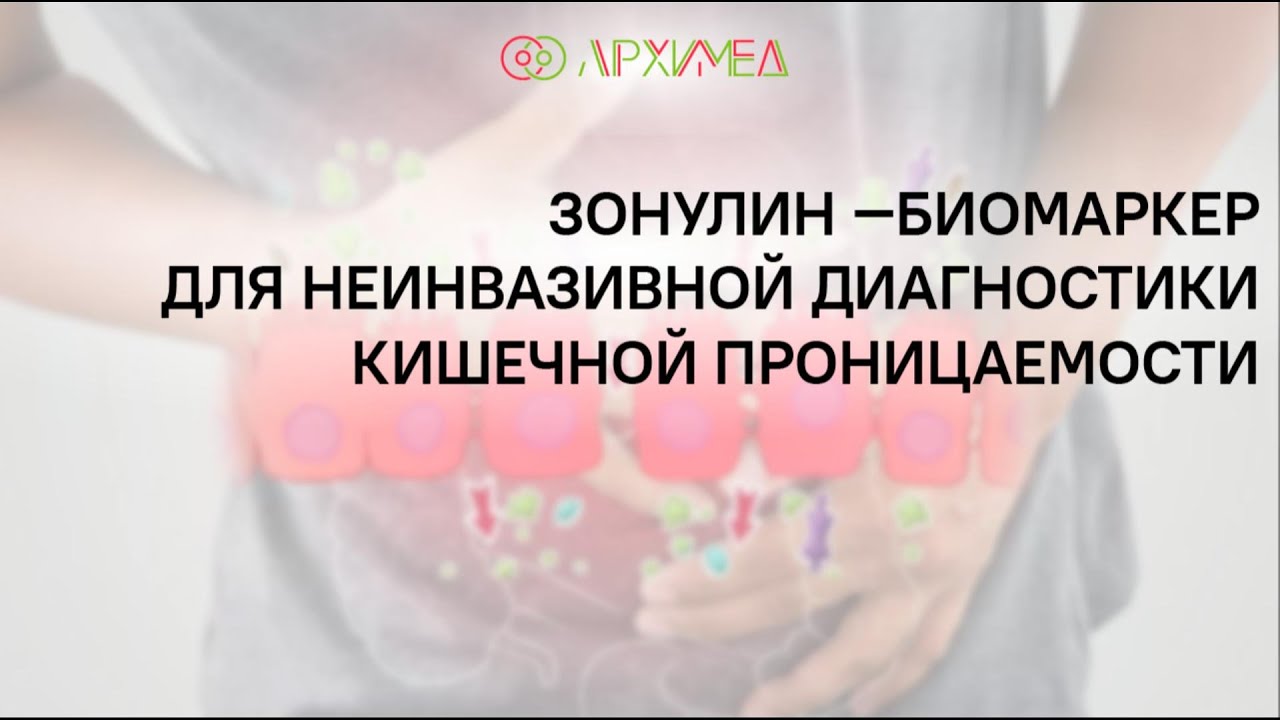 Зонулин —биомаркер для неинвазивной диагностики кишечной проницаемости