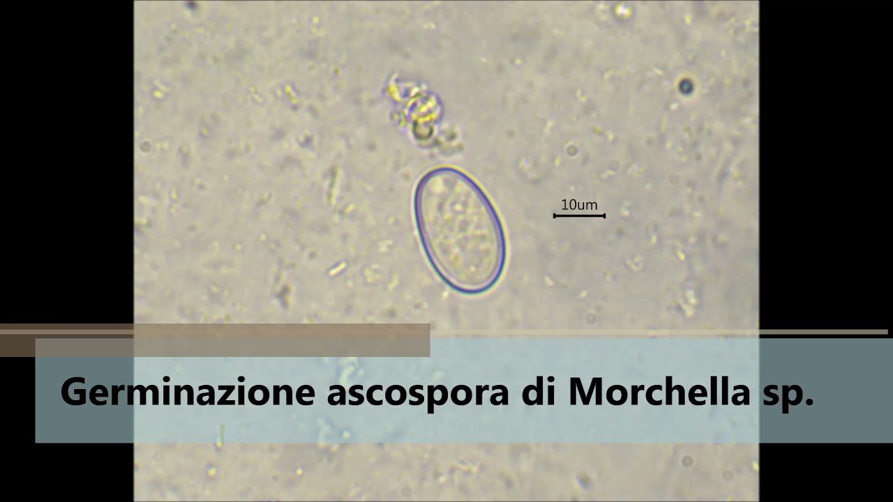 Timelapse germinazione di un ascospora di Morchella sp. - Esperimento di germinazione spora 🔬