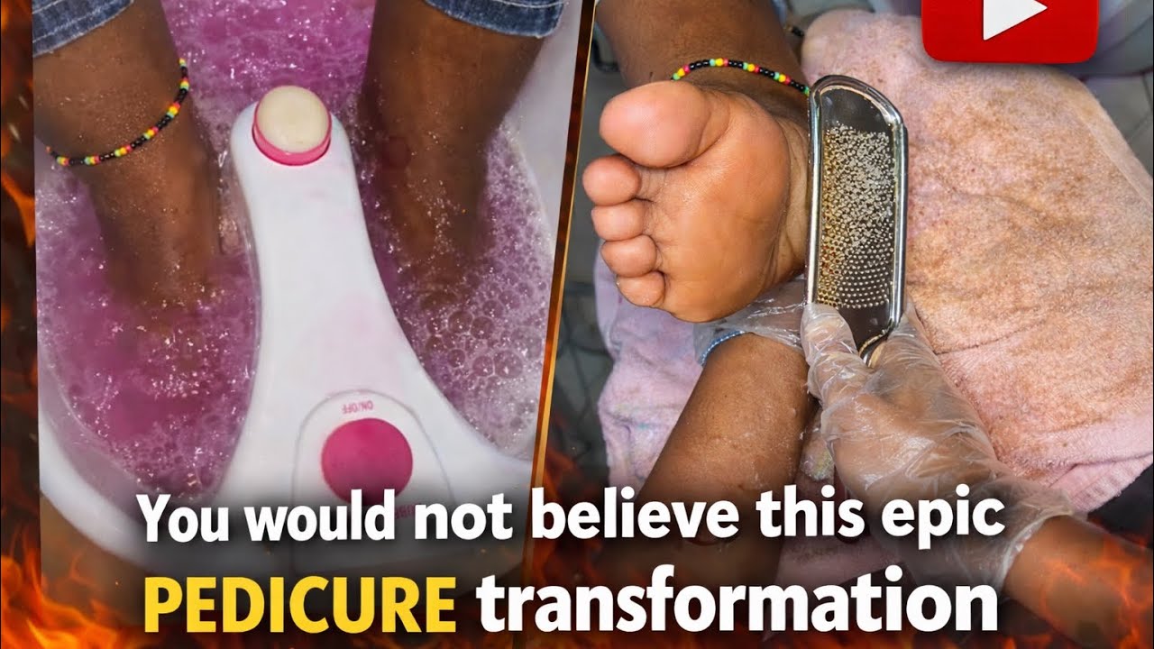 WATCH THIS PEDICURE TRANSFORMATION | Beginner friendly Step by Step Tutorial