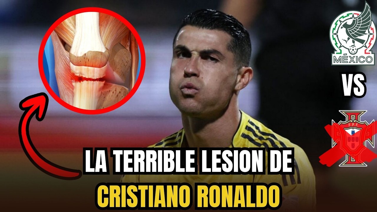 La terrible LESION de Cristiano Ronaldo 2026 &iquest;NO JUEGA CONTRA MEXICO?