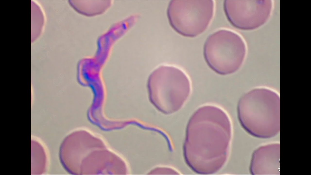 Introduction aux Protozoaires