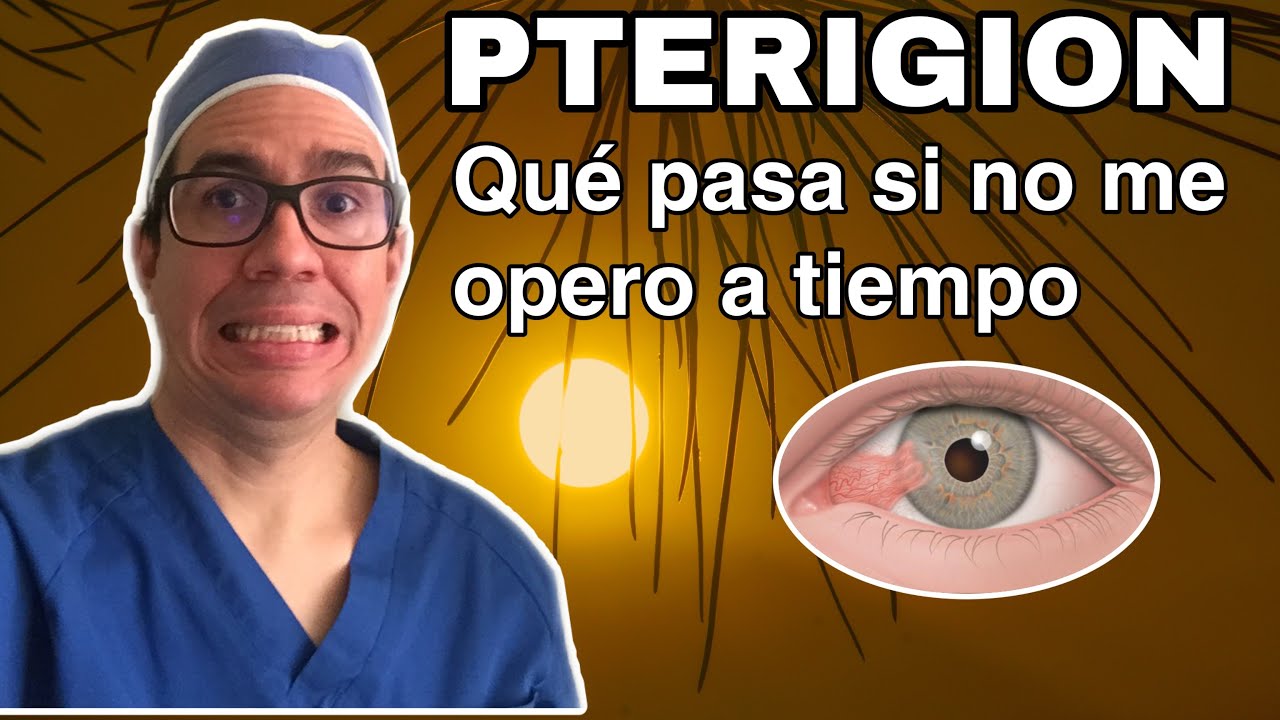 Qué pasaría SI NO ME OPERO a tiempo LA CARNOSIDAD  (PTERIGION) [2020] 👁😷👨🏻‍⚕️