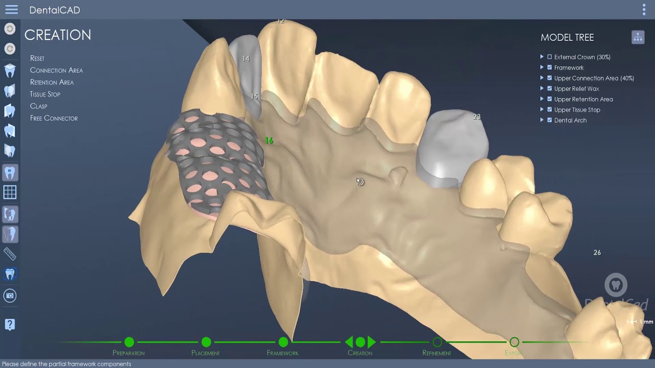 DentalCad 2019 - Prótesis parciales removibles