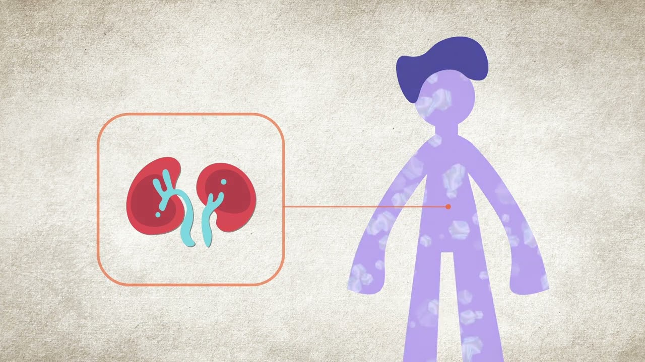 Wysoki poziom potasu (hiperkaliemia) &ndash; objawy i przyczyny | National Kidney Foundation
