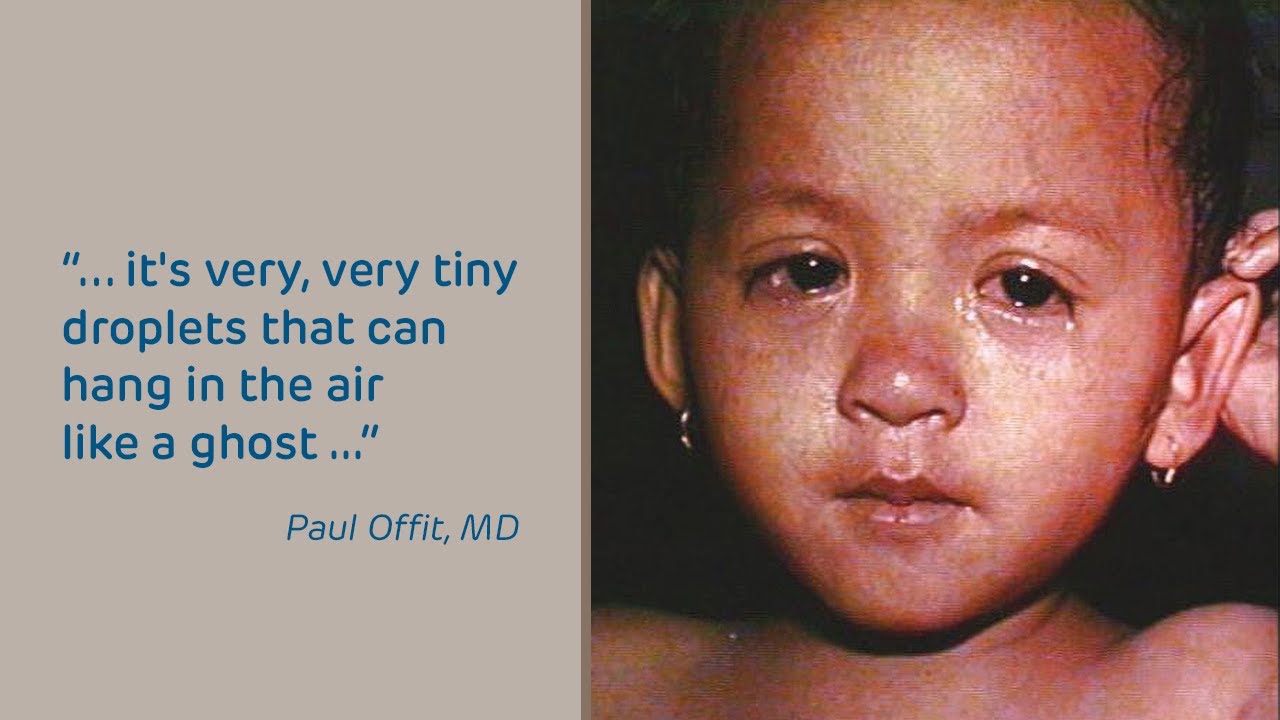 Measles: symptoms, spread & SSPE | Doctors Talk | Children’s Hospital of Philadelphia