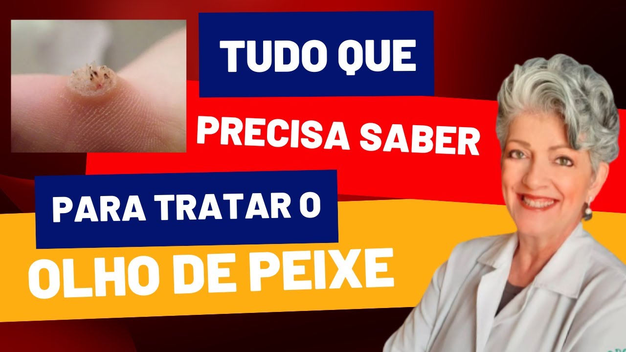 Tudo Sobre o Tratamento do OLHO DE PEIXE