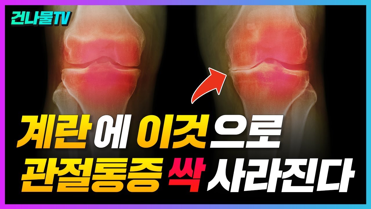 무릎 통증, 관절염 이렇게 관리하면 싹 사라져요