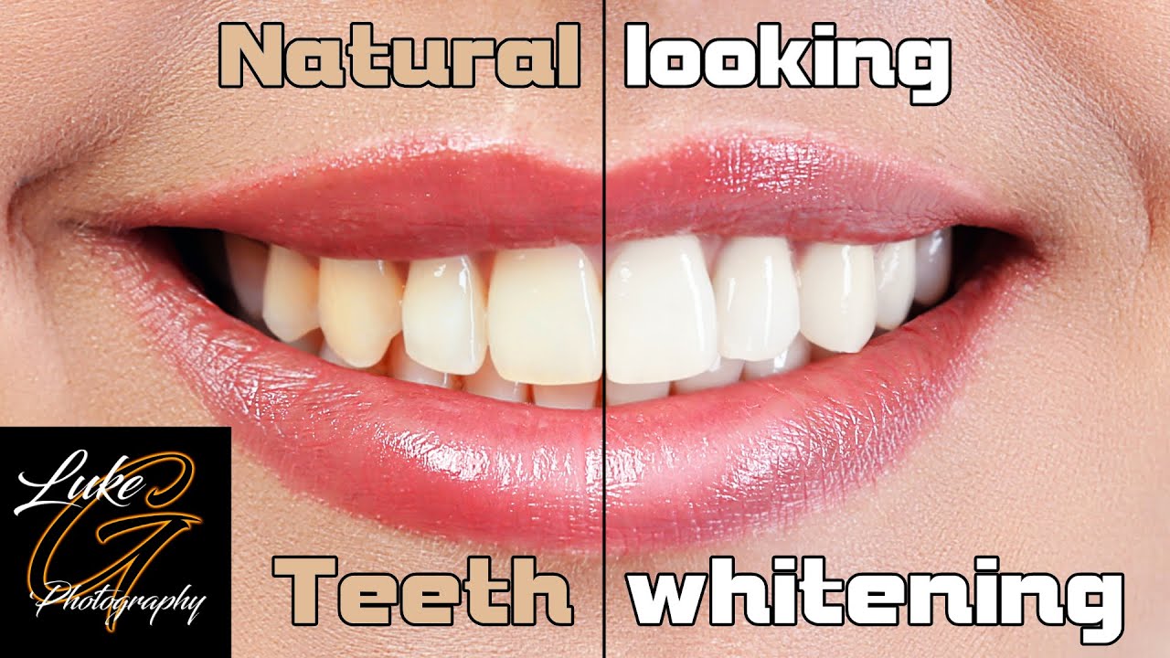 Easy and Fast Teeth Whitening with Affinity Photo