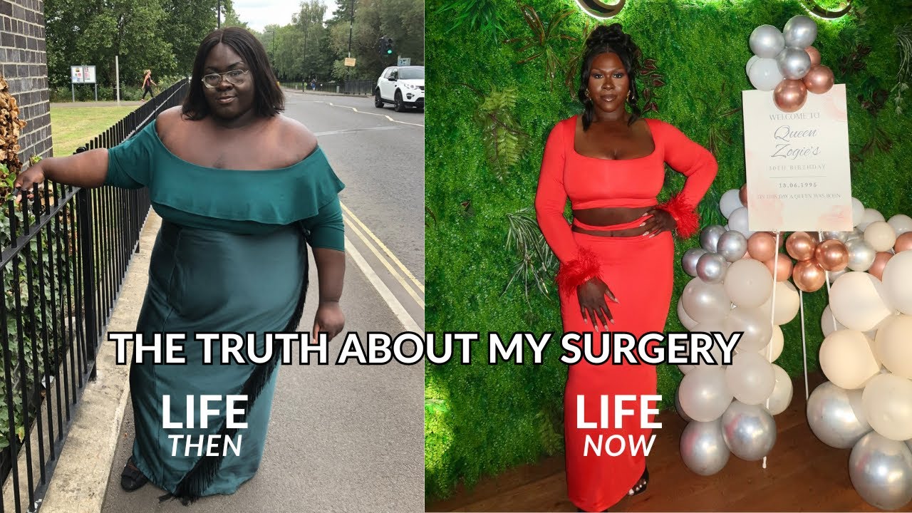 I LOST 100KG & HAD RECONSTRUCTIVE SURGERY