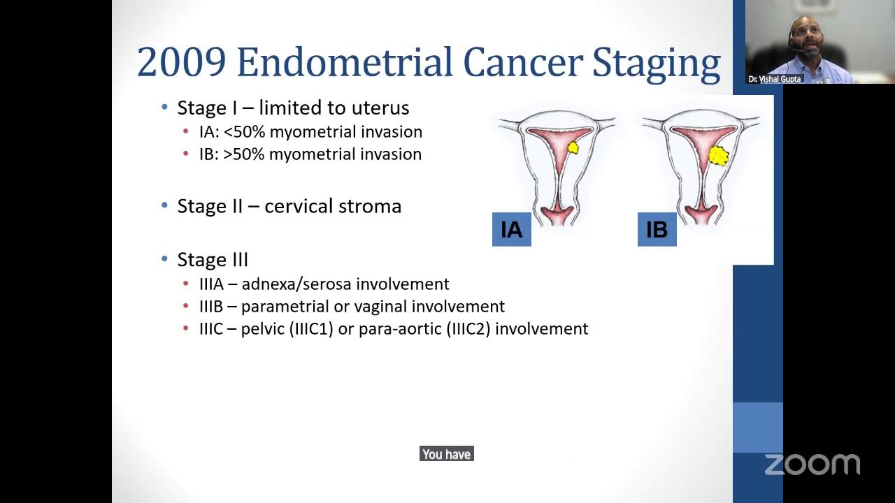 Radiation and Uterine Cancer: What You Need to Know