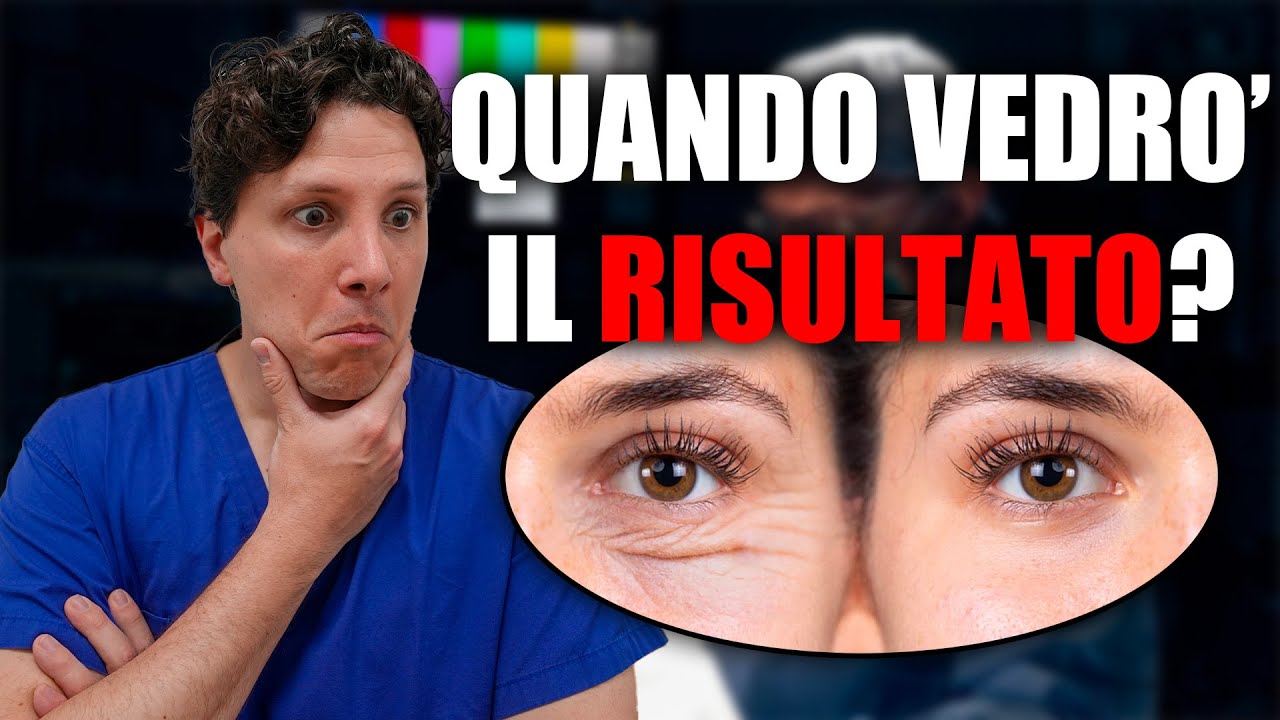 Blefaroplastica: Quando si vedrà il Risultato Finale?