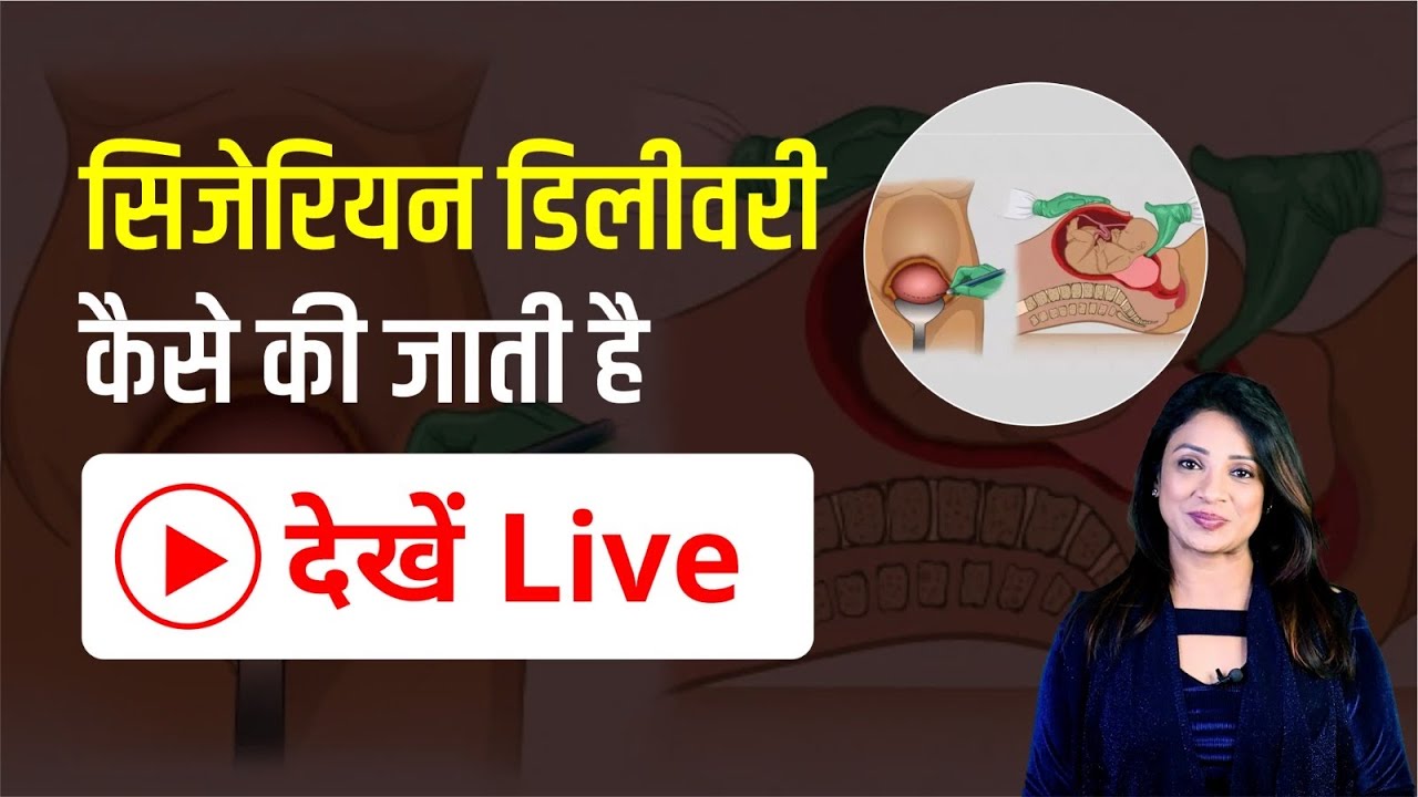 C-section: सिजेरियन डिलीवरी क्यों और कैसे की जाती है, देखें 3D में - Cesarean delivery in Hindi |