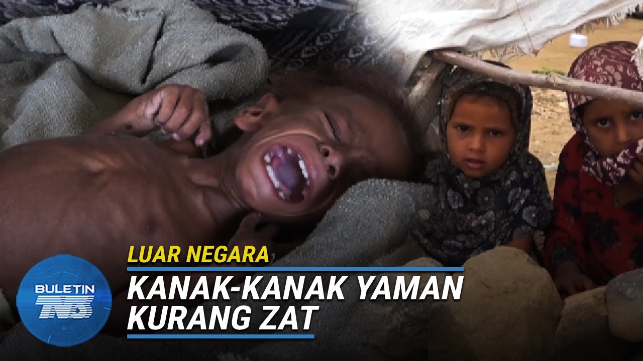 KRISIS KEMANUSIAAN | Berat Cuma 9kg Kerana Kebuluran