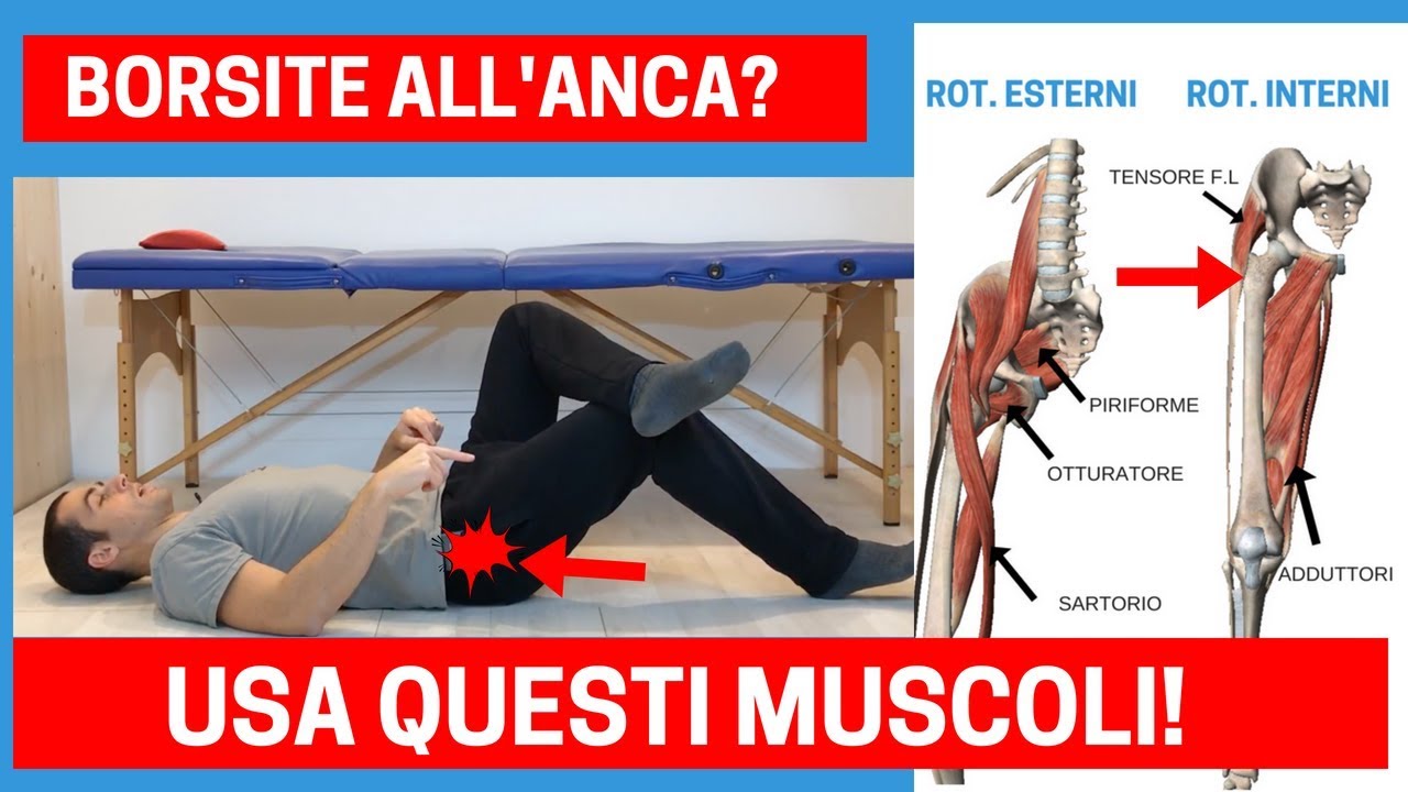 Questi 2 muscoli possono risolvere la tua BORSITE TROCANTERICA!