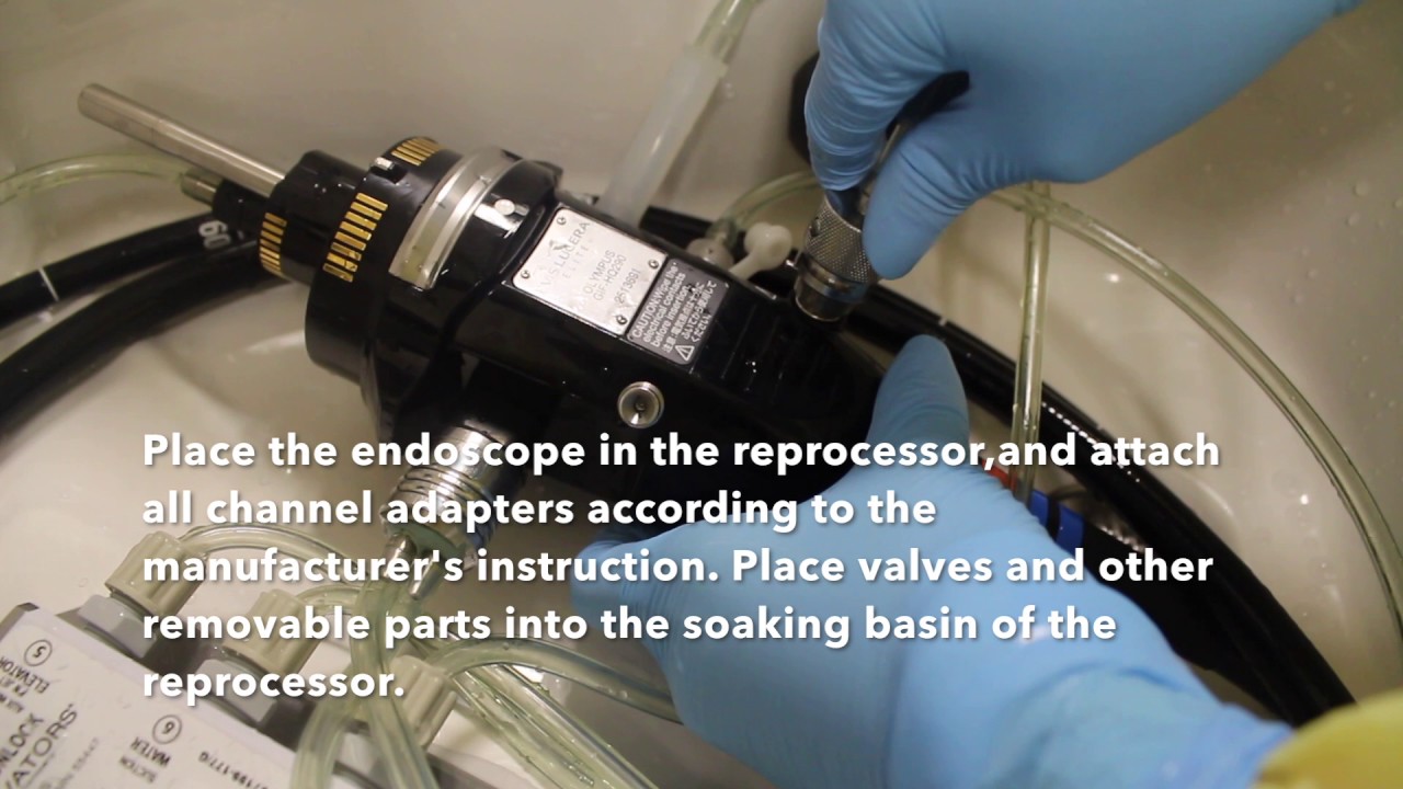 ENDOSCOPE REPROCESSING