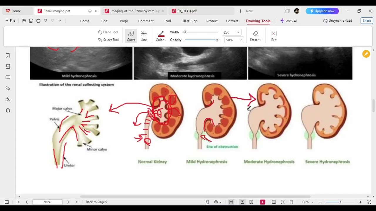 Renal Imaging by FLASH - radiology course