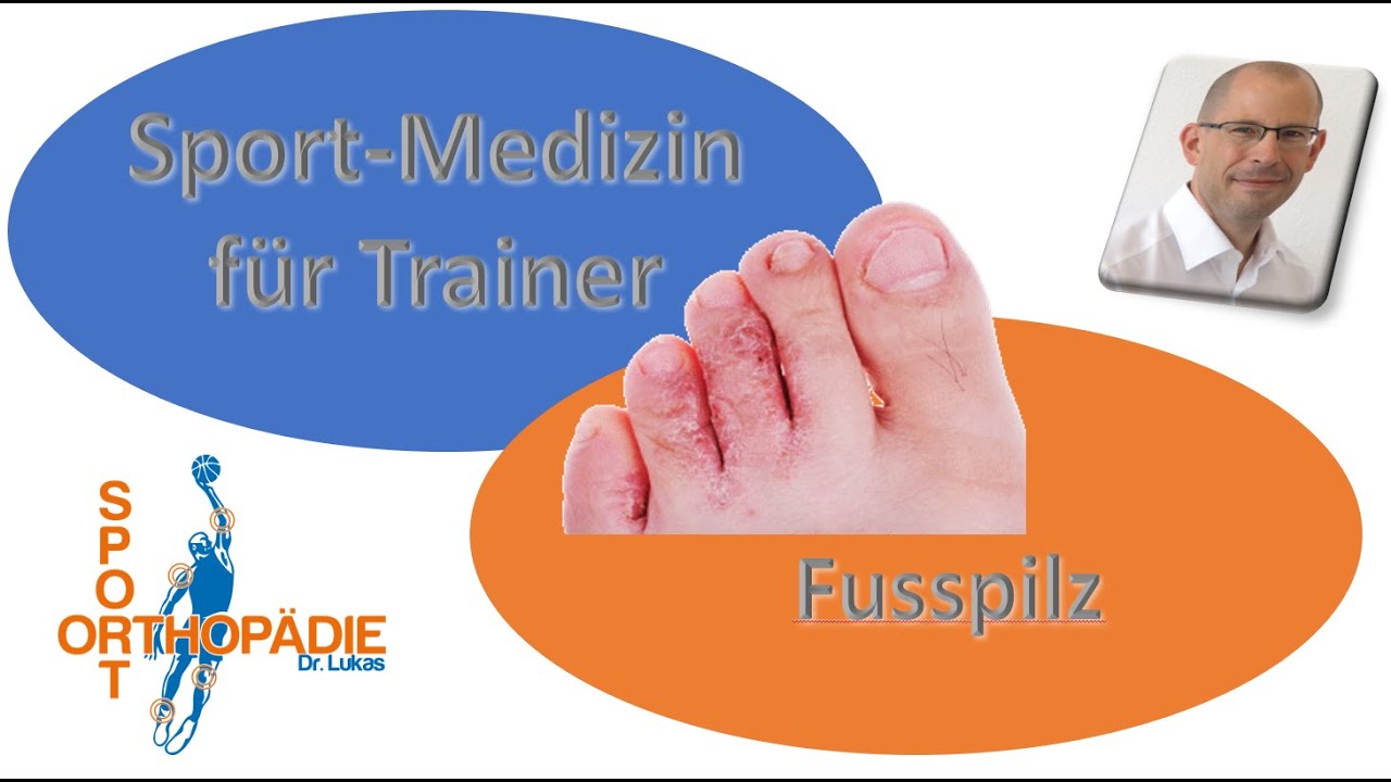Fusspilz, eklig, nervig, unnötig - Sportmedizin für Trainer