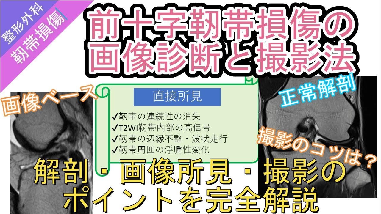 前十字靭帯損傷の画像診断と撮像法