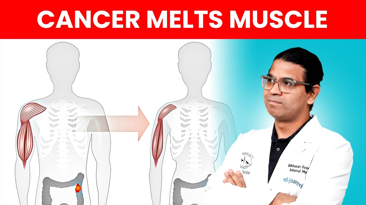 Cancer Cachexia Mechanism Explained | Why Cancer Causes Severe Weight & Muscle Loss?