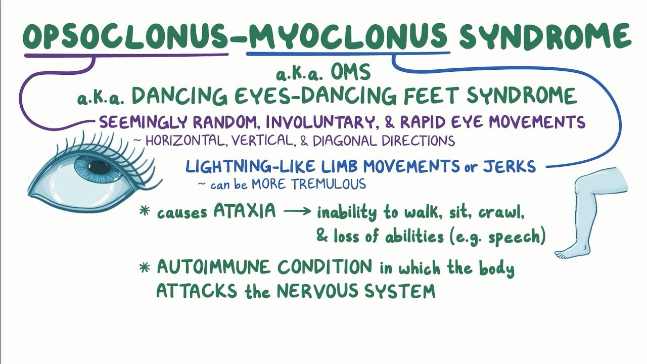 Opsoclonus Myoclonus Syndrome: Symptoms, Challenges, and Treatment Options